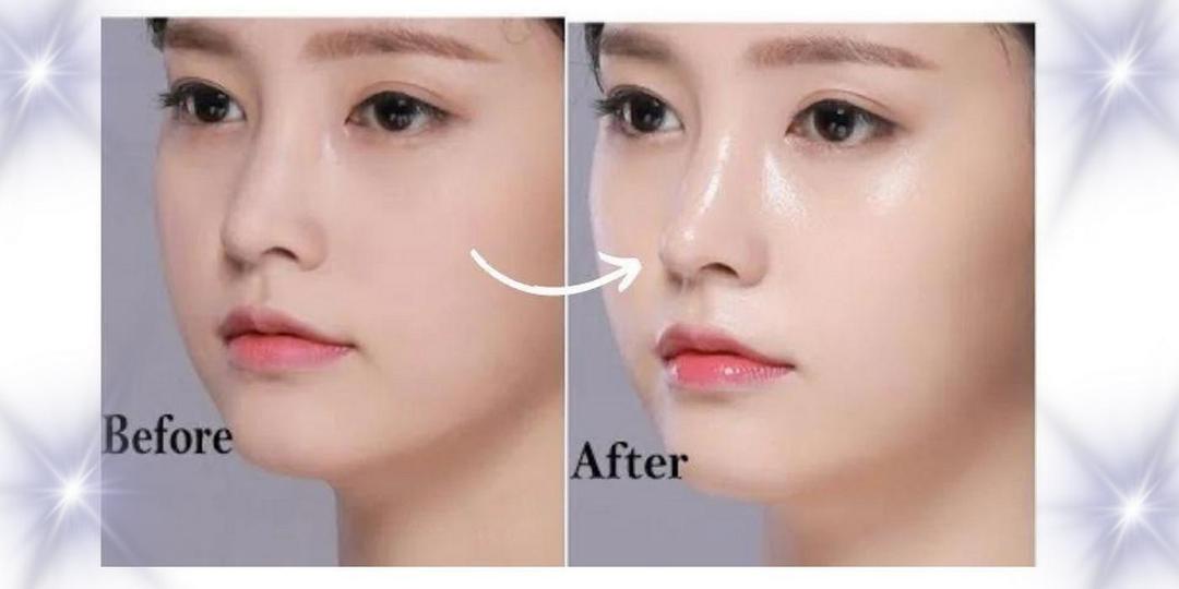 Korean Glass Skin Brightening Serum - Hydrating Facial Glow Treatment 30ml