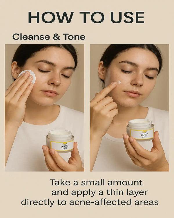 Clear Skin Hydrating Acne Shield Gel | 50ml Gentle Exfoliating Formula